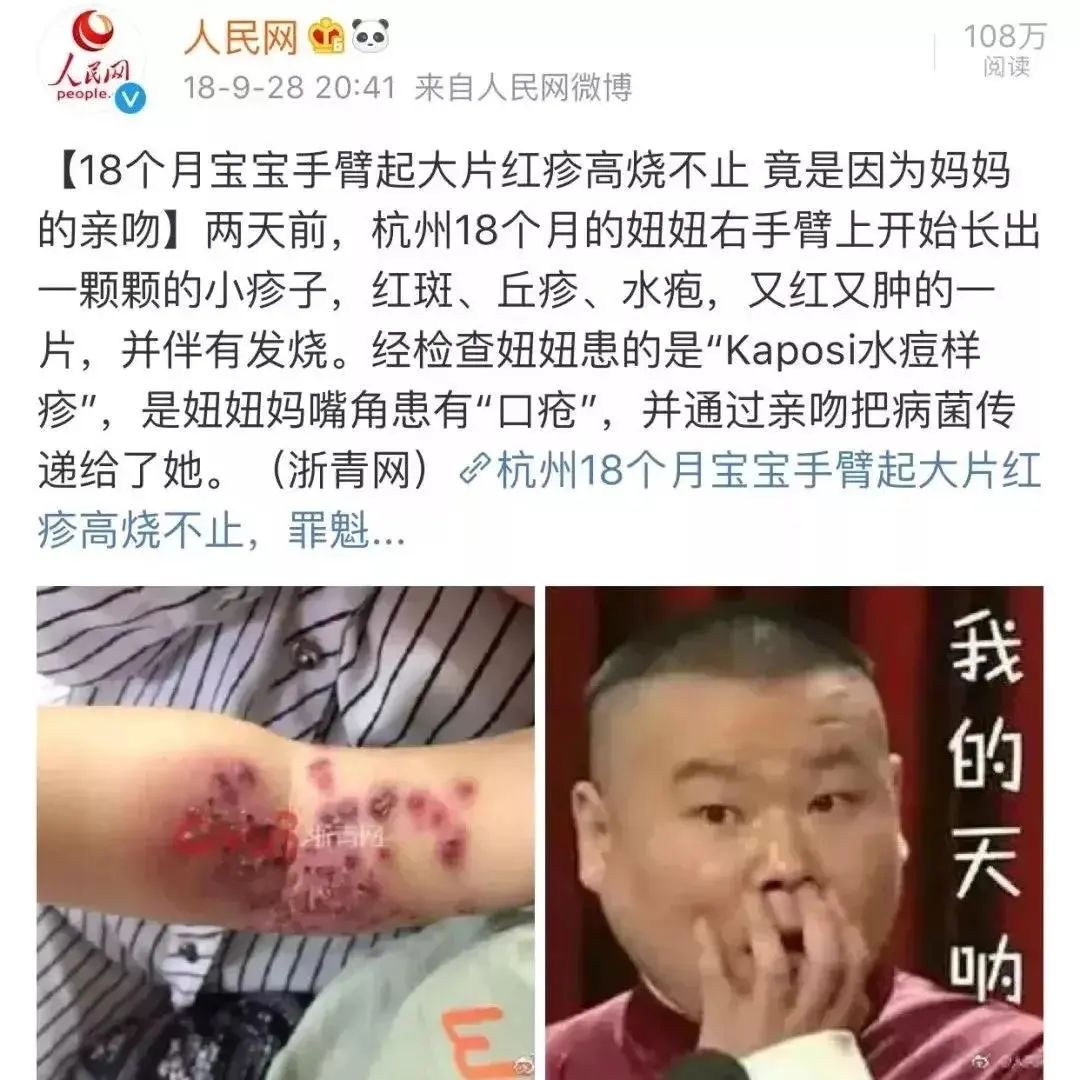 心碎，18天女嬰因親吻致死，千萬別在讓人親吻你家的寶寶了！